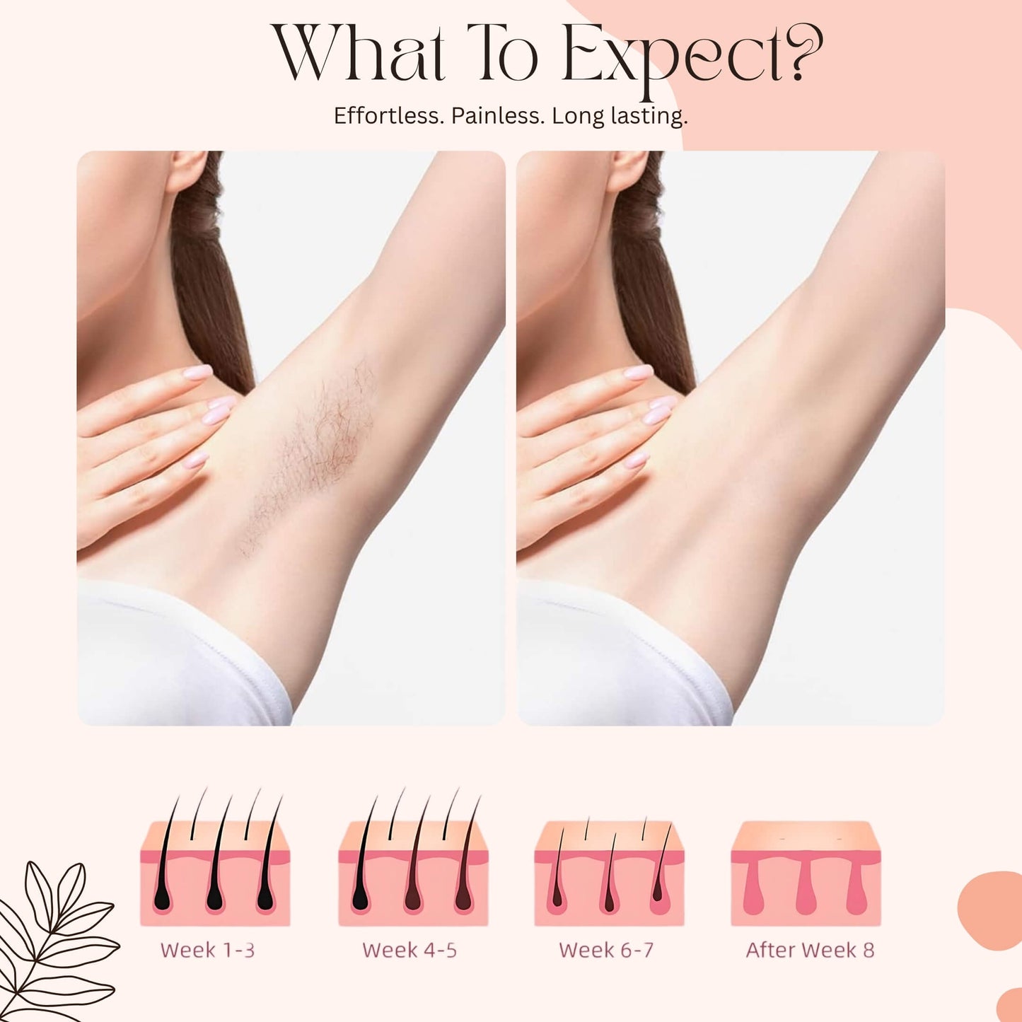 GlowX™ — Painless IPL Hair Removal