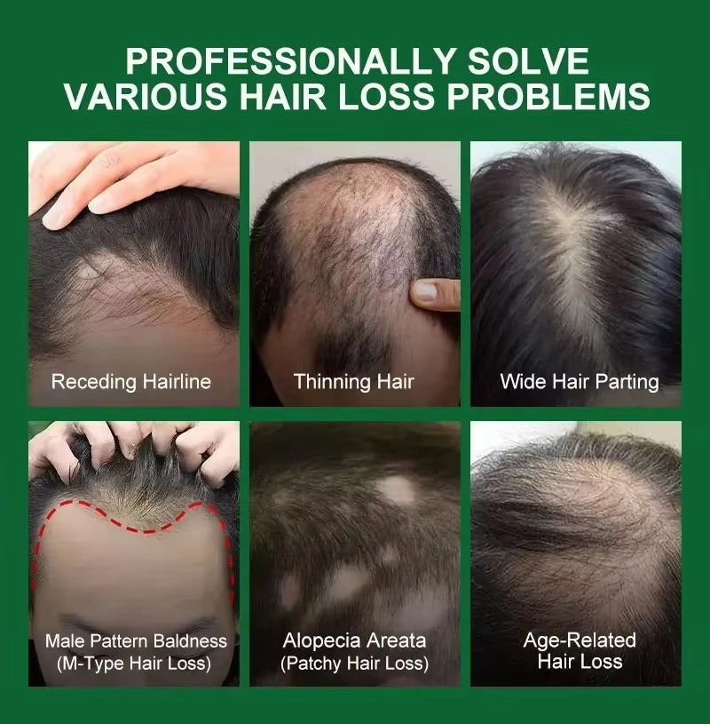 RootRevive™ Fast Hair Growth Spray