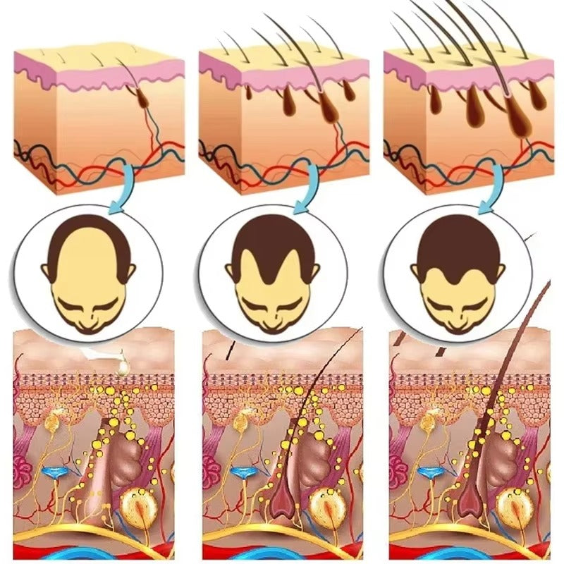 GingerBoost™ 7-Day Hair Growth Serum