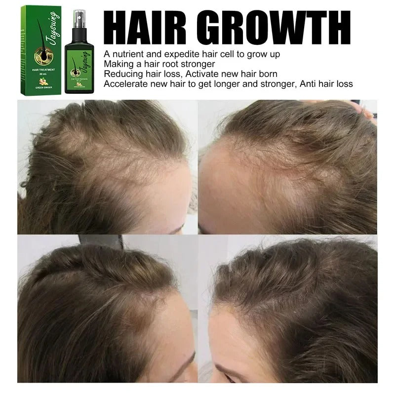 RootRevive™ Fast Hair Growth Spray