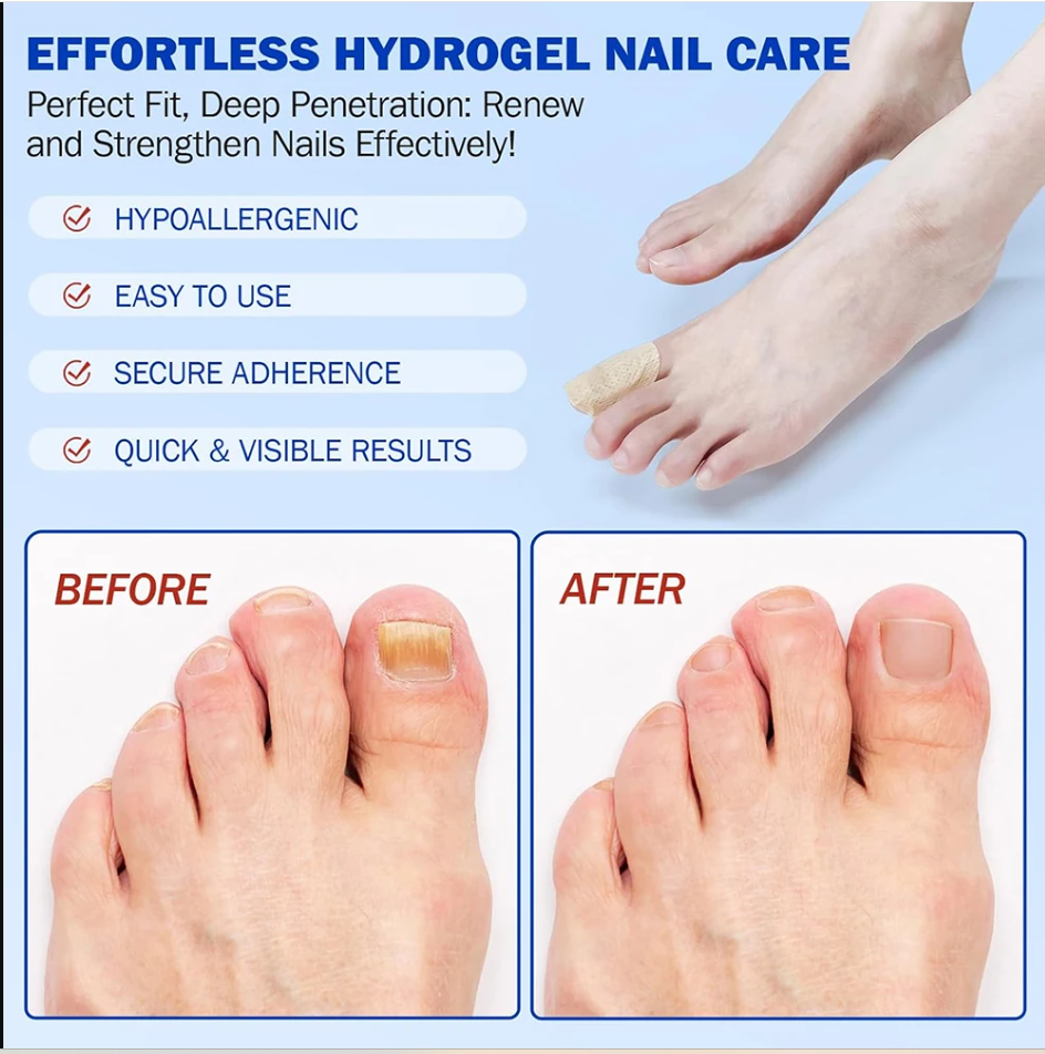 7-Day Nail Revival Patches Rapid Fungal Defense