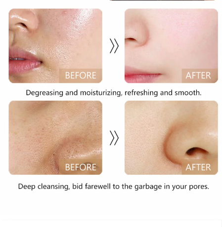 Oil Control Facial Cleanser