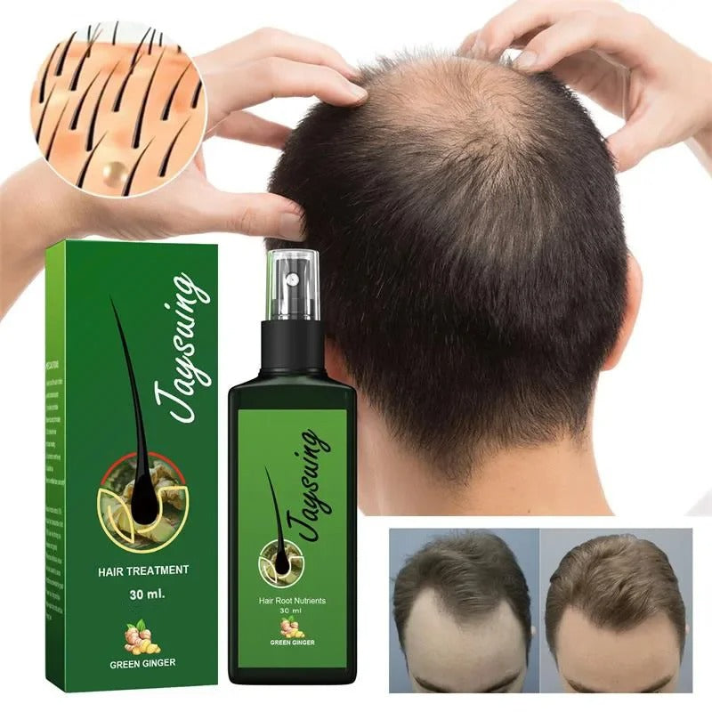 RootRevive™ Fast Hair Growth Spray