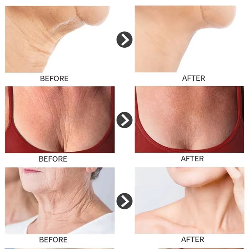 Noticeable wrinkle reduction in as little as 7 days.
