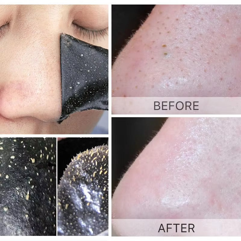 7-Day Deep Pore Detox Nose Strips — Powerful Blackhead Removal Patches