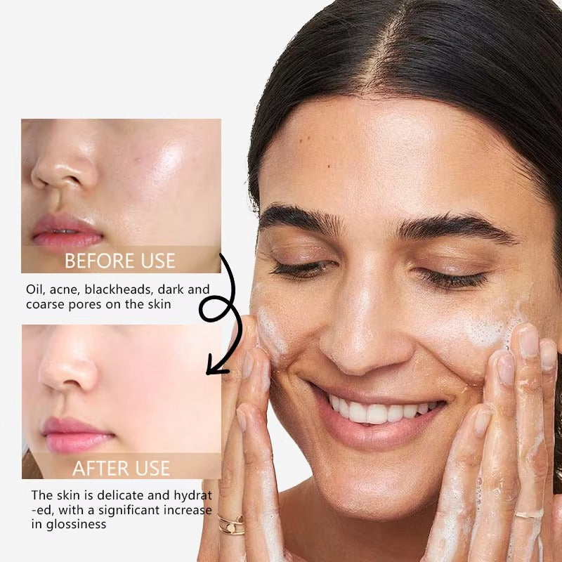 Oil Control Facial Cleanser